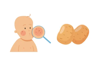 Аллергия на картошку у ребенка фото фото
