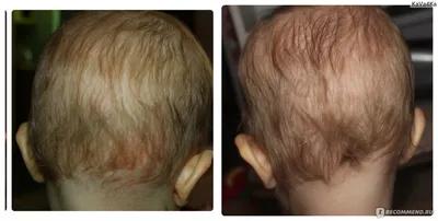 Лук для волос фото до и после фото