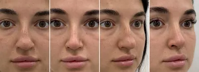 Как определить характер по форме носа? | Ганцавіцкі час
