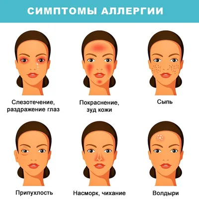 Аллергия на лице как проявляется и от чего