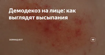 ФитоБиоТехнологии Stop Demodex - Бальзам лечебно-профилактический \"Стоп  демодекс\": купить по лучшей цене в Украине | Makeup.ua