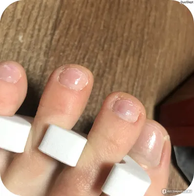 24 шт., лаки для ногтей среднего и большого пальцев ногтей | AliExpress