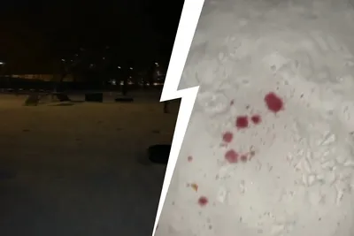 Картинки кровь на снегу фотографии