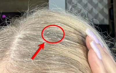 Как избежать эффекта ёлки на волосах? | ПроДива