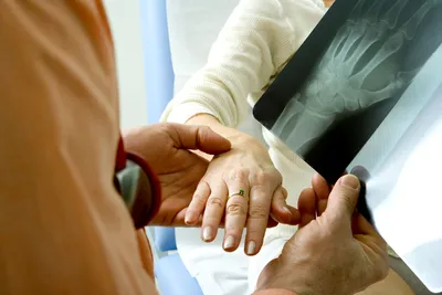Псориатический артрит - причины, симптомы, диагностика, лечение и  профилактика