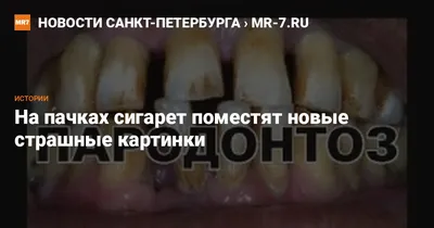 Чиновники предложили увеличить страшные картинки на пачках сигарет |  Новости Саратова и Саратовской области сегодня