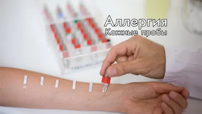 Диета ребенка, страдающего аллергией — Лечение аллергии и астмы в Аллергомед