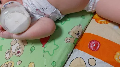 Аллергия на картофель у взрослых и детей: симптомы и лечение