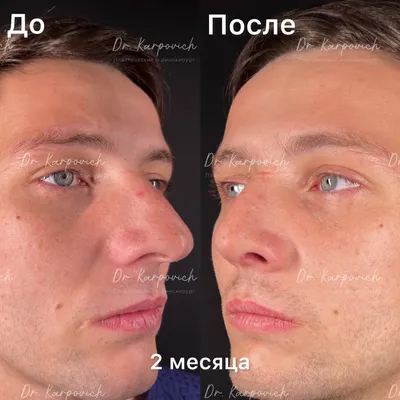 Как уменьшить нос в домашних условиях с помощью макияжа - YouTube