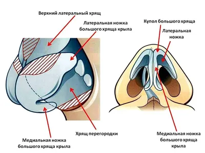 Ринопластика цена в Новосибирске - cколько стоит ринопластика носа в Dune  Ego