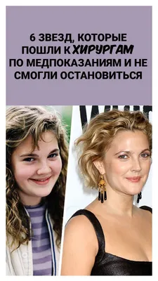 6 звезд, которые пошли к хирургам по медпоказаниям и не смогли остановиться  | Красота лица, Косметолог, Красота