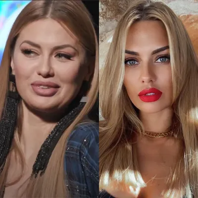 Звезды до и после пластики носа: фото знаменитостей - 300 экспертов.РУ