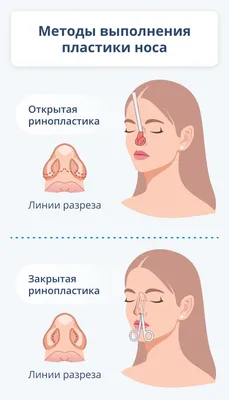 15+ знаменитостей, решивших застраховать части своих тел на баснословные  суммы