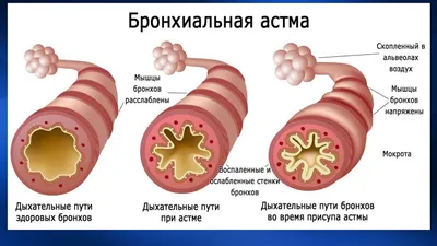 Расписные бочки на даче 23 фото