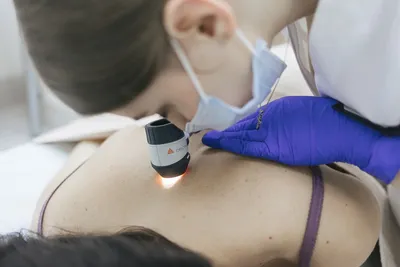 Удаление липомы | Damas Medical Center