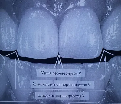Шаблоны иконок для Актуального в Instagram | Canva