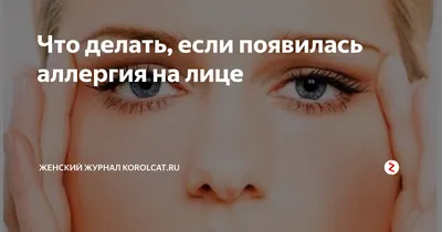 Аллергическая крапивница - лечение у взрослых и детей