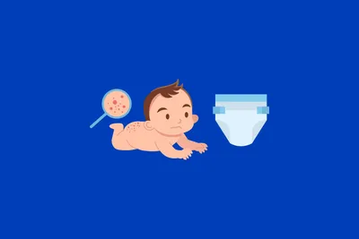 Отзывы о подгузники для новорожденных Pampers Premium Care 1 (2-5 кг), 72  шт. - отзывы покупателей на Мегамаркет | подгузники для малышей -  100023453555