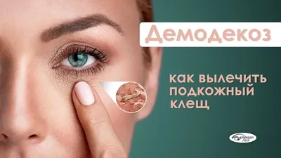 Увлажняющий гель для лица Демотен от прыщей демодекоза 100мл - цена 439  руб., купить в интернет аптеке в Москве Увлажняющий гель для лица Демотен  от прыщей демодекоза 100мл, инструкция по применению