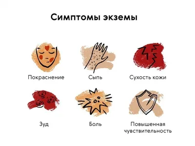 Экзема у детей: виды, причины, методы лечения
