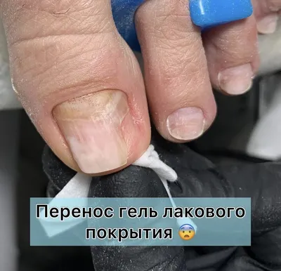 Ольга Тихонова - Покрывать ли ногти на ногах гель лаком? Вы задаёте себе  этот вопрос перед процедурой? Сейчас я думаю, что большинство все-таки  ответит - ДА! Наконец все вокруг стали больше задумываться