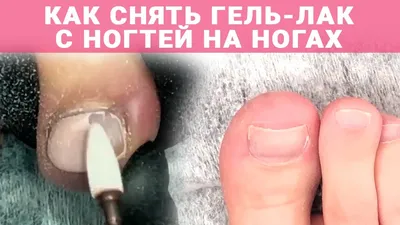 Нужно ли снимать гель-лак на ногах❓ Несколько дней назад в сториз подробно  разбирали этот вопрос, решила оставить его в посте, т.к.… | Instagram