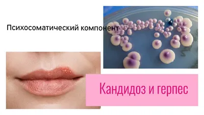 Герпес: симптомы и лечение, рекомендации врача | Семейный доктор