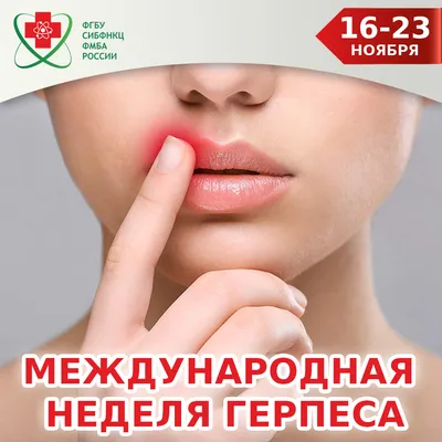 Герпес Что Это Такое (Симптомы Разновидности) 8 Видов Как Его Лечить