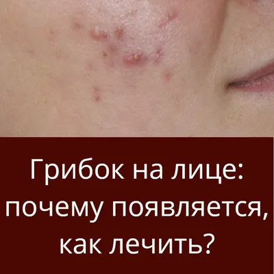 Интересное | Лицо, Домашнее лечение, Натуральные маски для лица