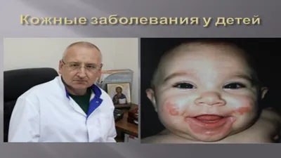 Убрать морщины на лице в Ульяновске — Многопрофильная клиника Н.Березиной  Ульяновск
