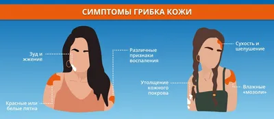 Лечение грибка ногтей в Санкт-Петербурге: профессиональное лечение  онихомикоза в клинике «МедЛайн».