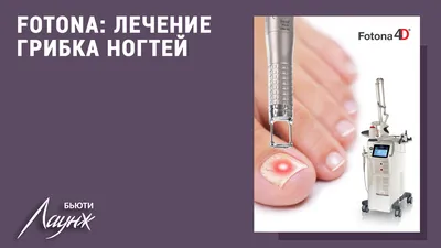 Лазерное удаление сосудов на лице.... - Фотоэпиляция ПМР | Facebook