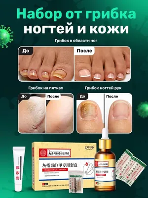 Медицинский педикюр при грибке ногтей | Где в Москве сделать чистку  грибковых ногтей