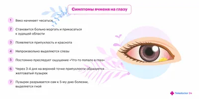 Капли для глаз Др.Герхард Манн Флоксал - «Ячмень внутри глаза. О том,  почему важно правильно смывать глиттеры» | отзывы