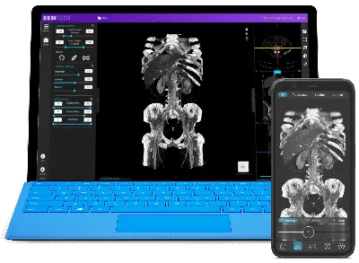 xml - how to create 3D shape of layout or Or button in android - Stack  Overflow
