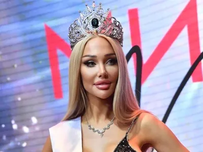 Девушка С Эдельвейсами В Suryakencana Sacana Гора Геде Западная Ява  Индонезии Фотография, картинки, изображения и сток-фотография без роялти.  Image 20787058