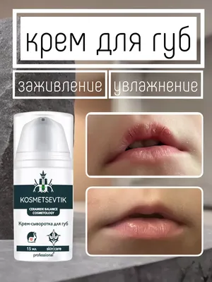 Как увеличить губы и скорректировать форму губ: способы, виды инъекций,  побочные эффекты – блог Cleo Line