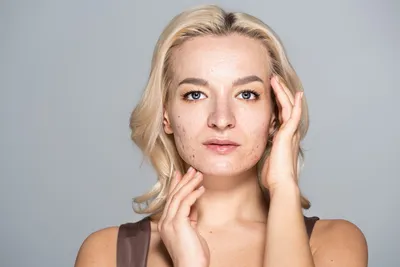 Китайская карта лица ➤ Публикация ⭐ Косметологической Клиники BeautyMED