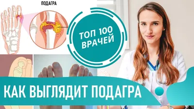 Почему могут возникать боли в руках? | МедИнфо | Дзен
