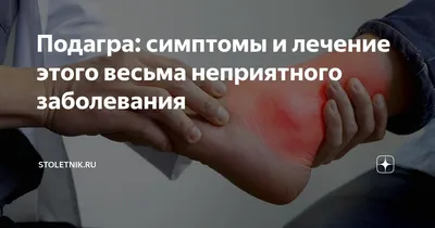 Kinexib - Болезнь королей и королева болезней - подагра Подагра —  хроническое заболевание, связанное с нарушением мочекислого обмена в виде  повышения содержания в крови мочевой кислоты (гиперурикемии) и отложения ее  в виде