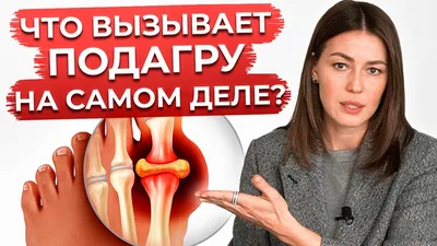 Подагра схематическая диаграмма рисованной элементы PNG , подагра, руки и  ноги, схематическая диаграмма PNG картинки и пнг PSD рисунок для бесплатной  загрузки