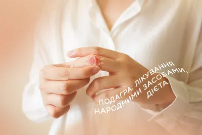 6 шт./кор. лечения подагры патч пальцев на руках и ногах, корректор для  большого пальца стопы облегчение боли медицинский пластырь для ног кости с  накатанной головкой корректор наклейки здравоохранения | AliExpress