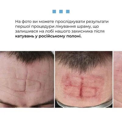 Россиянина оштрафовали за свастику на аватарке в WhatsApp — Ferra.ru