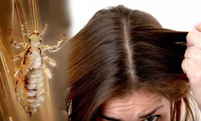 Как долго вши могут прожить без человека?