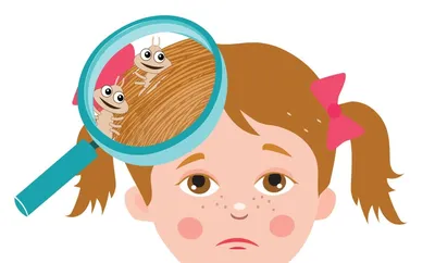Средство от вшей Нюда - «Как вывести вшей у ребенка. Пошаговая инструкция.»  | отзывы