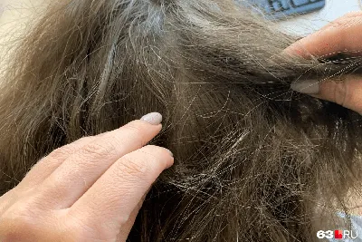 Все о головных вшах