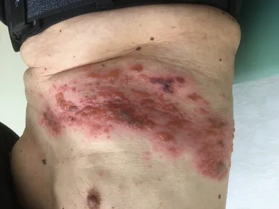 Так как блог у меня не только о медицине, но и немного обо мне, хотелось бы  рассказать о своей мечте, достигнув которой, я был неимоверно… | Instagram
