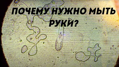 Microbes on hands under a microscope | Why should you wash your hands? -  YouTube