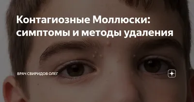 Контагиозный моллюск | Пикабу