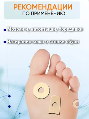 Почему появляются мозоли, волдыри и натоптыши на ногах и как от них  избавиться | Russia Running | Дзен